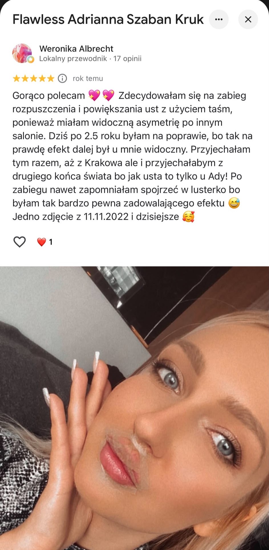 Opinia klientki Flawless