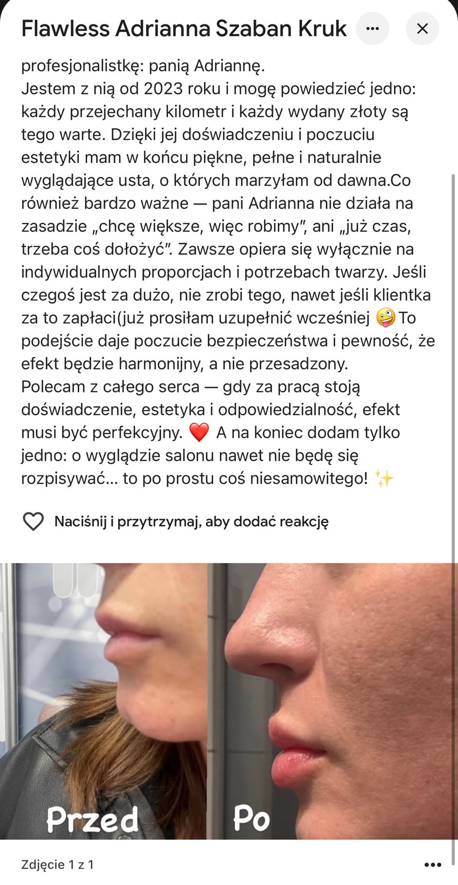 Opinia klientki Flawless